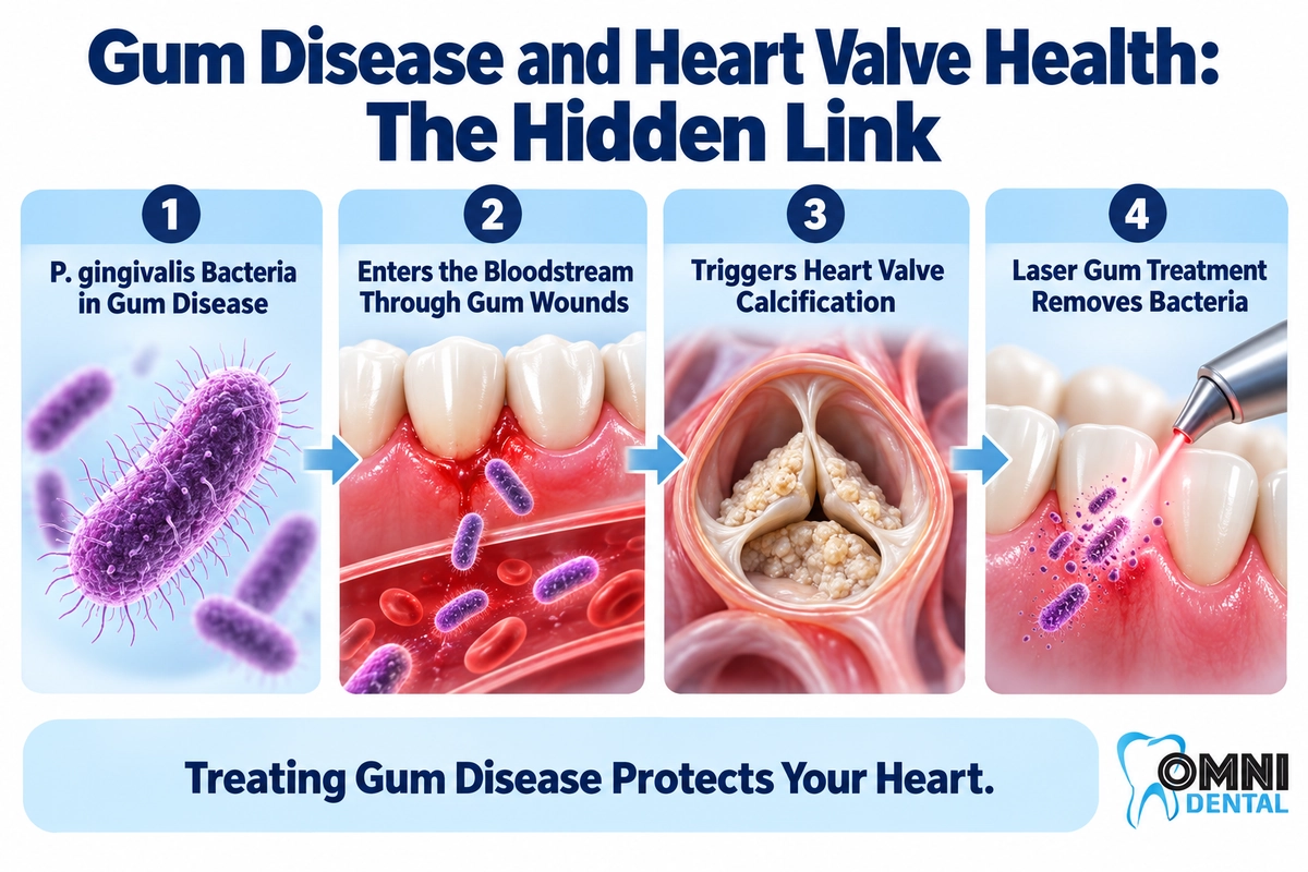 2026 AHA Research-P. gingivalis and Heart Valve Disease