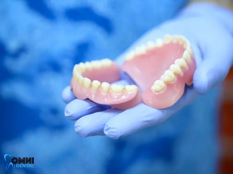 How to prepare for veneers procedure to minimize pain and discomfort