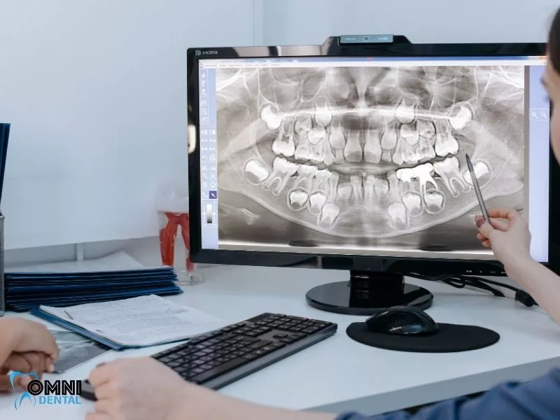 The Importance Of Oral Cancer Screenings