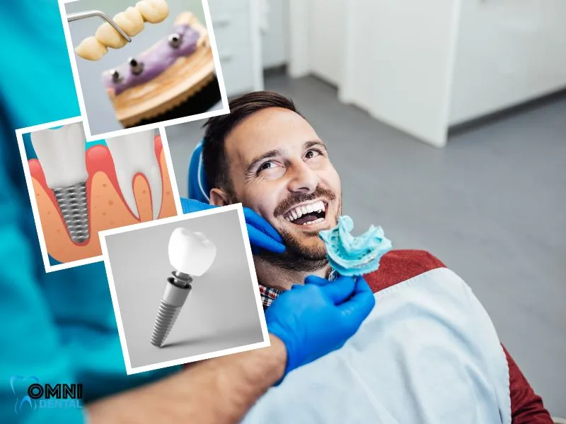 cost of single tooth implant