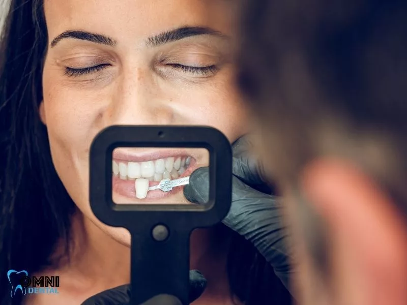 dental implant cost