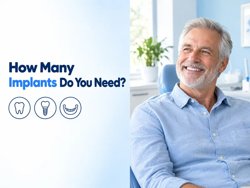 All on 4 vs all on 6 headline image with a smiling older adult and icons for a tooth, an implant, and a full arch