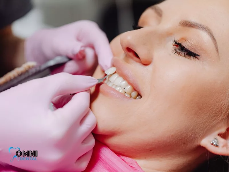 Alternative Solutions for a Brighter Smile