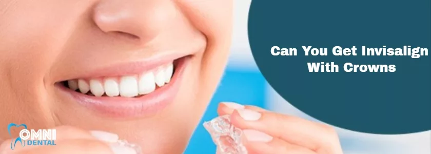 Can You Get Invisalign With Crowns