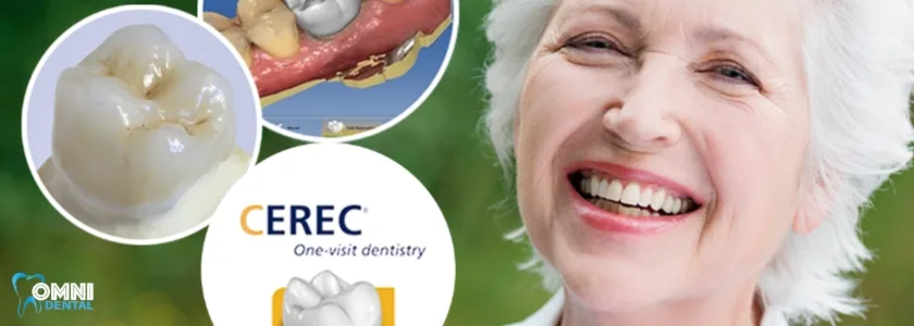 SAME-DAY DENTAL CROWNS IN ARLINGTON HEIGHTS, IL