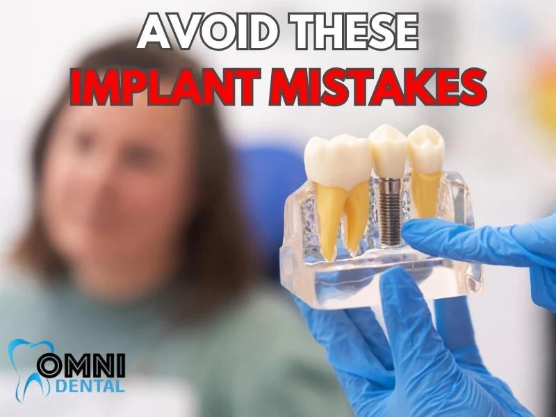 Dental Implants-Common Mistakes Patients Make