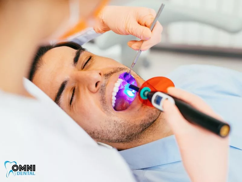 what are dental sealants made of