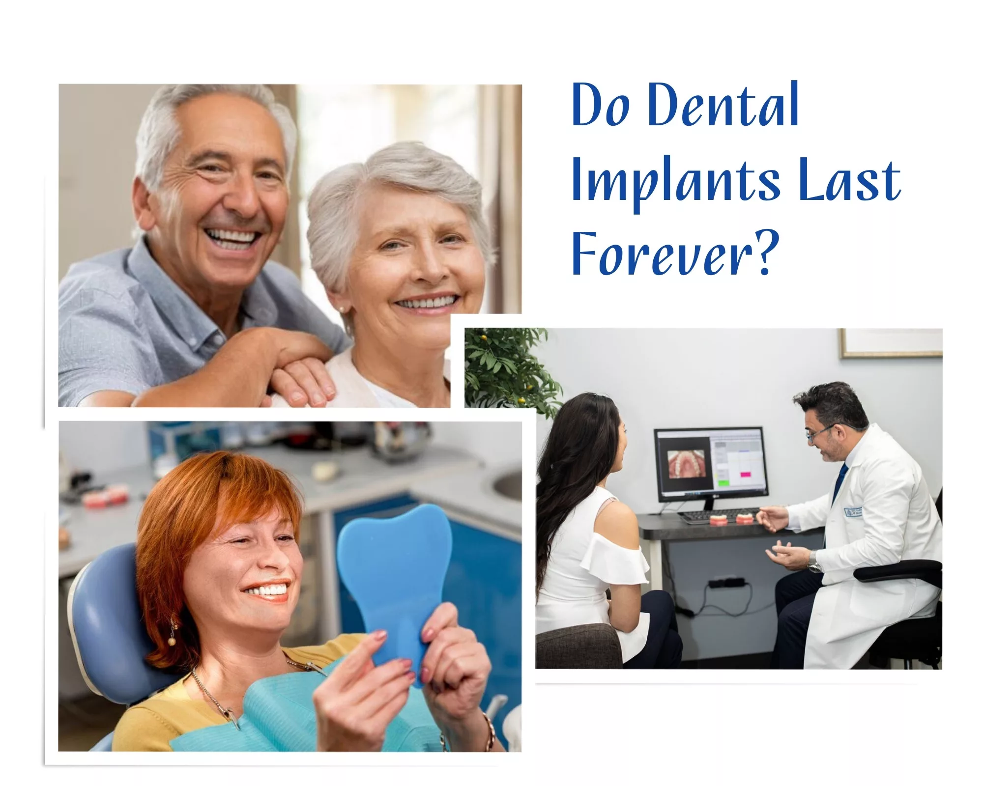 Do Dental Implants Last Forever