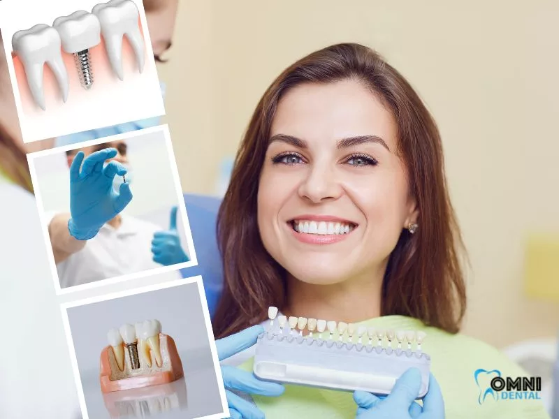 Full Arch Dental Implants Near Me: Arlington Heights IL