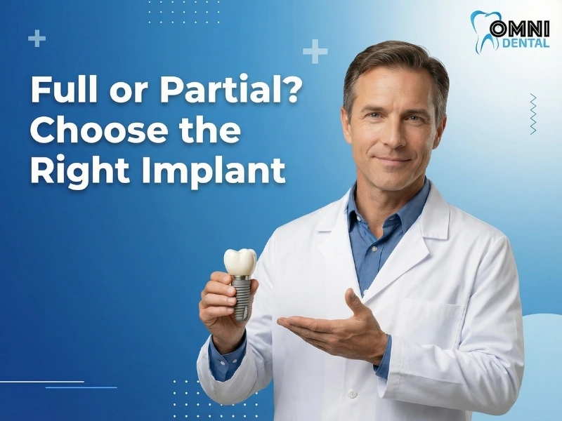 Full vs Partial Dental Implants Explained