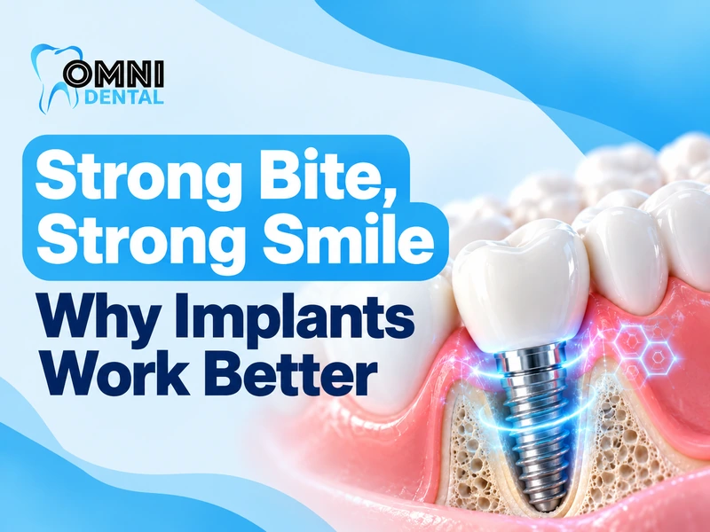How Dental Implants Improve Your Bite Strength
