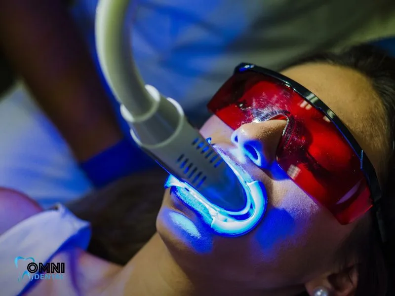 What is Teeth Whitening?