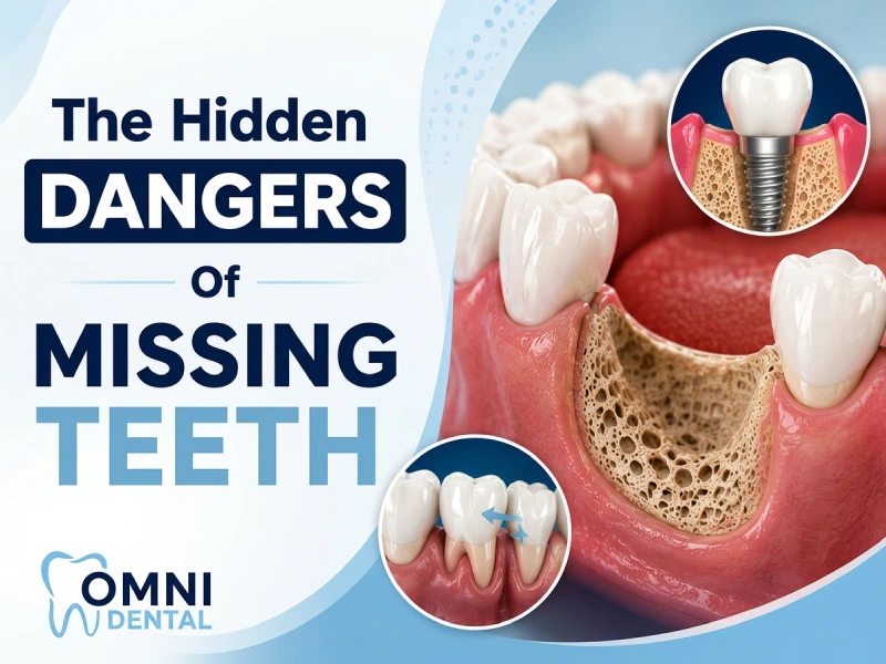 How Missing Teeth Impact Your Health