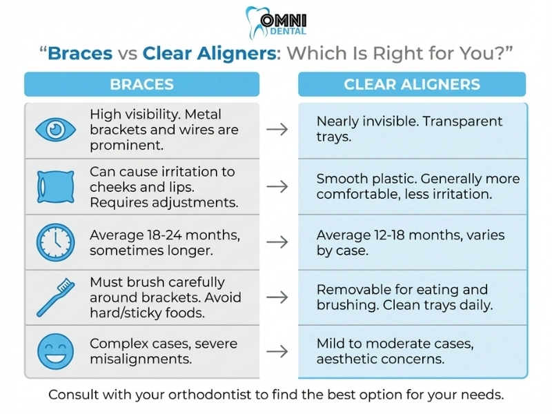 Key Differences Between Braces and Clear Aligners