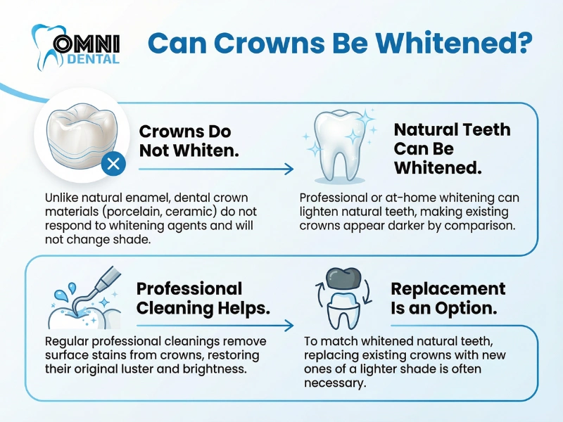 Managing expectations for crown whitening