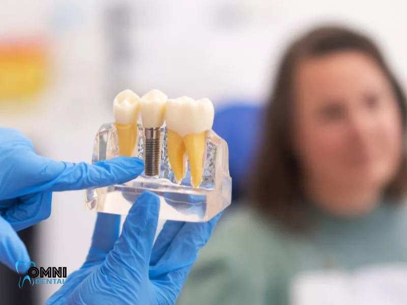 Who is not a candidate for All-on-4 dental implants?