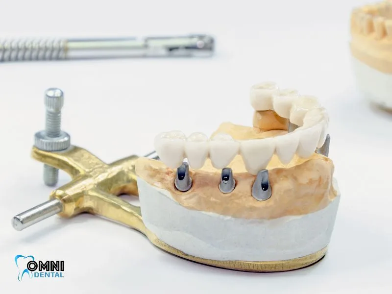 Regular Dental Check-ups