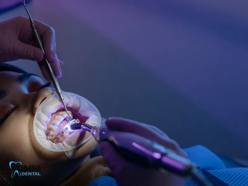 Can Orthognathic Surgery Fix a Gummy Smile?