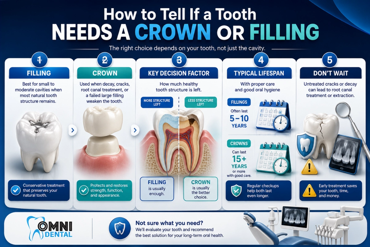 Signs a Tooth Needs a Crown Instead of a Filling