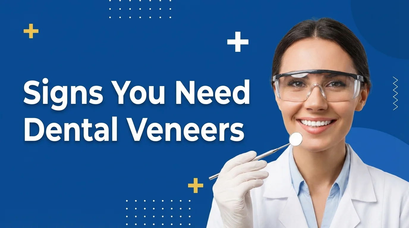 Signs You Need Dental Veneers