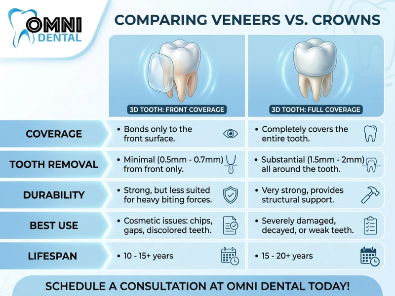 Simple Guide to Choosing Between Veneers and Crowns