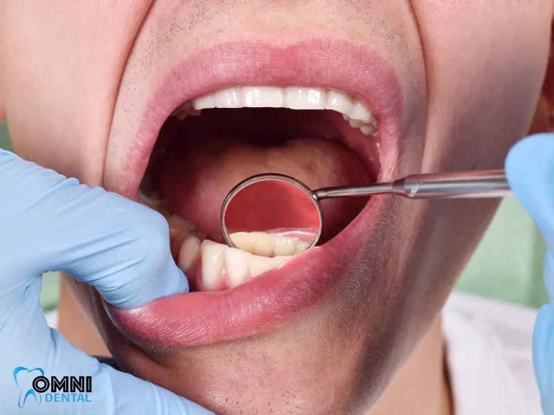The Role of Periodontal Treatment in Maintaining Oral Health