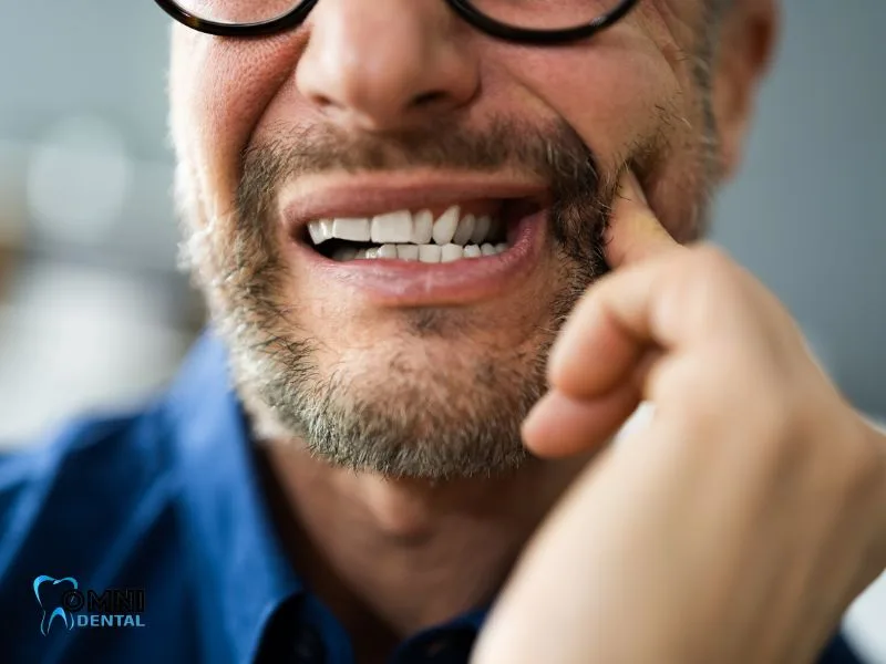 tooth decay treatment