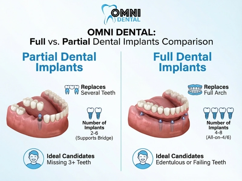 Understanding dental implants and how they work