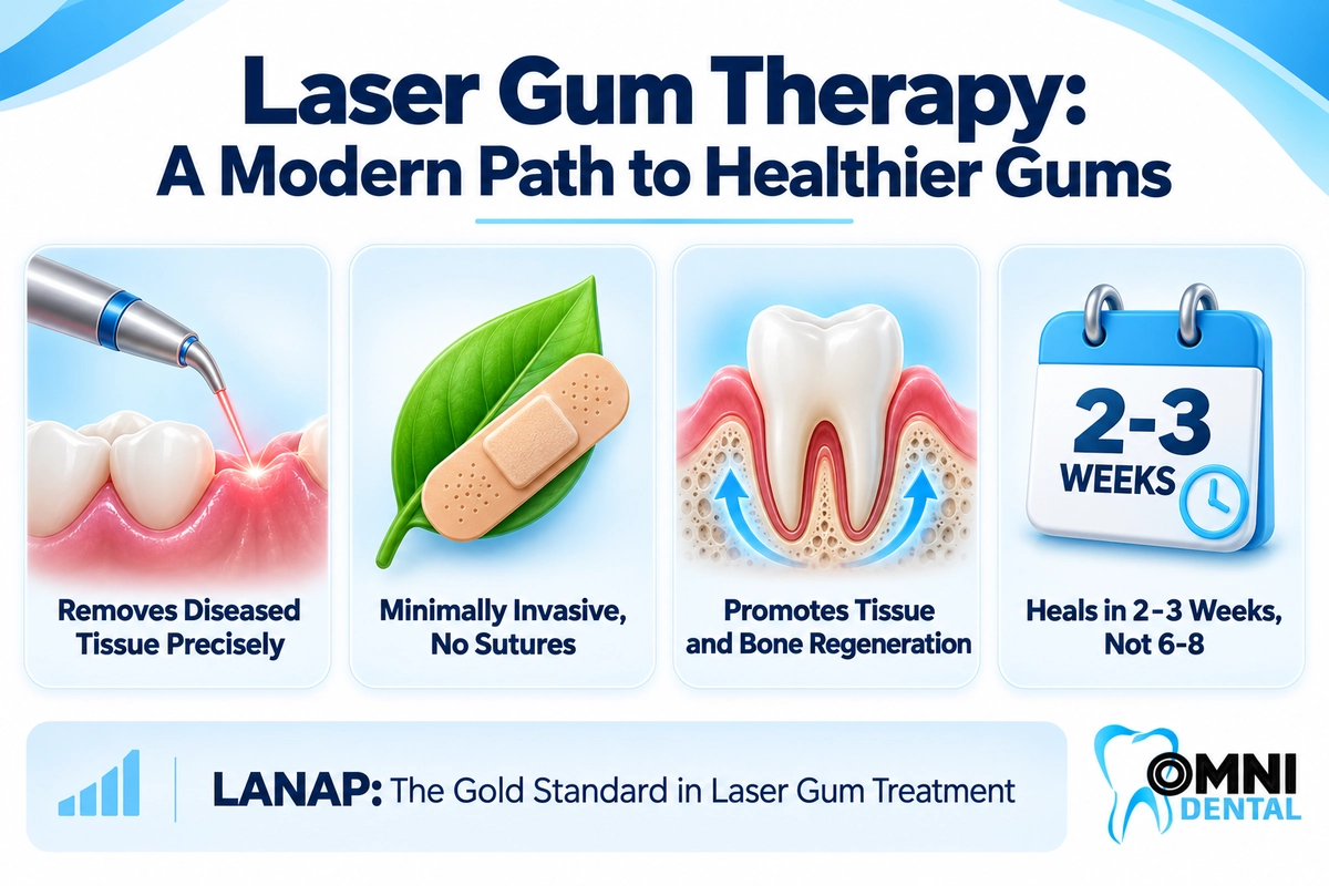 Understanding Laser Gum Therapy