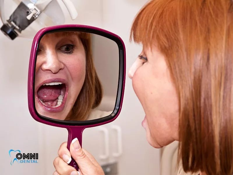 Are All-on-4 Implants Worth It?