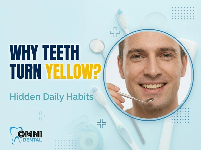 What Causes Tooth Discoloration Over Time