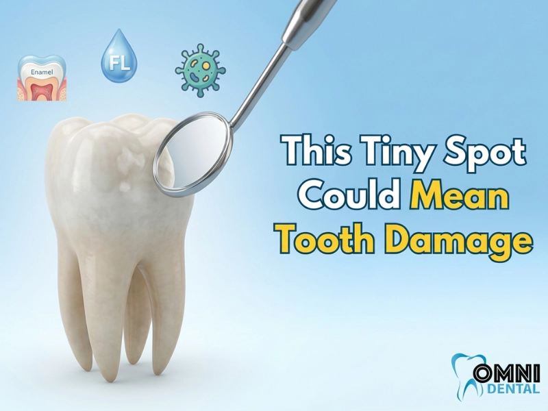 What Causes White Spots on Teeth