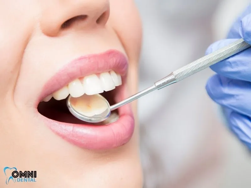 Why This Matters for Oral Health