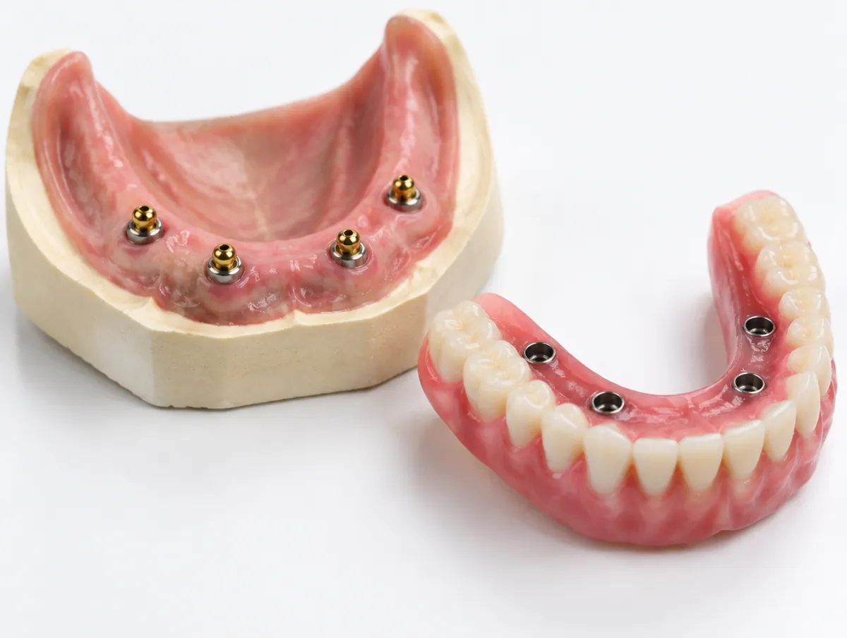 Snap in dentures cost: Omni Dental, Arlington Heights, IL