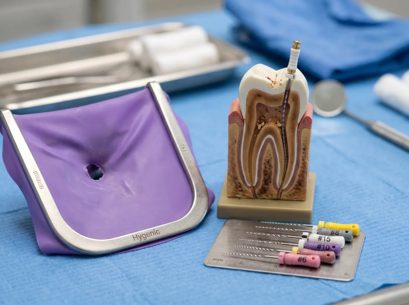 Root Canal Therapy for Emergency Situations rfsvf973nm3xvg2n7m3ff5xlr7kgnunag3dtvid9dk at Omni Dental in Arlington Heights, IL