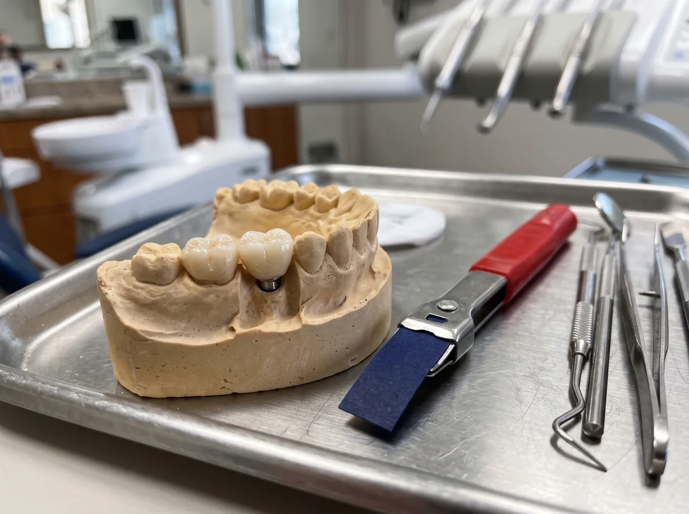 Same day implant crown check at Omni Dental in Arlington Heights, IL