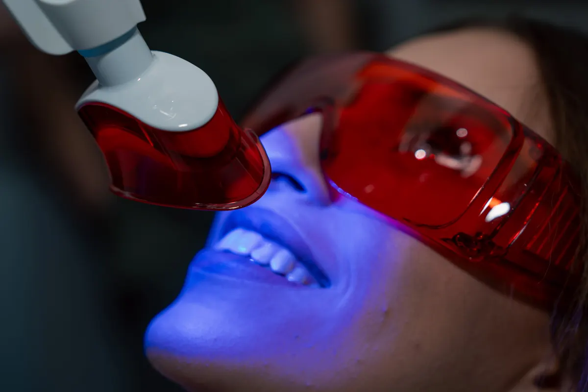 In office whitening light at Omni Dental in Arlington Heights, IL