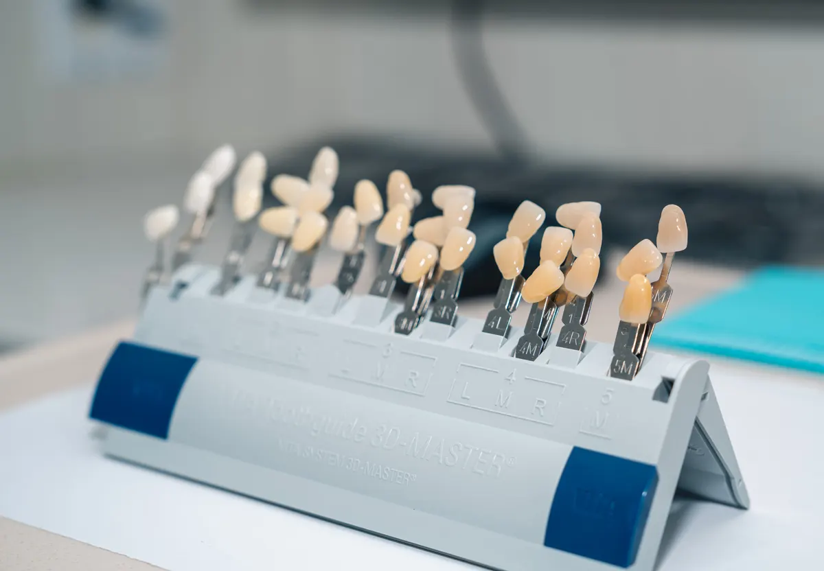 Porcelain shade guide at Omni Dental in Arlington Heights, IL