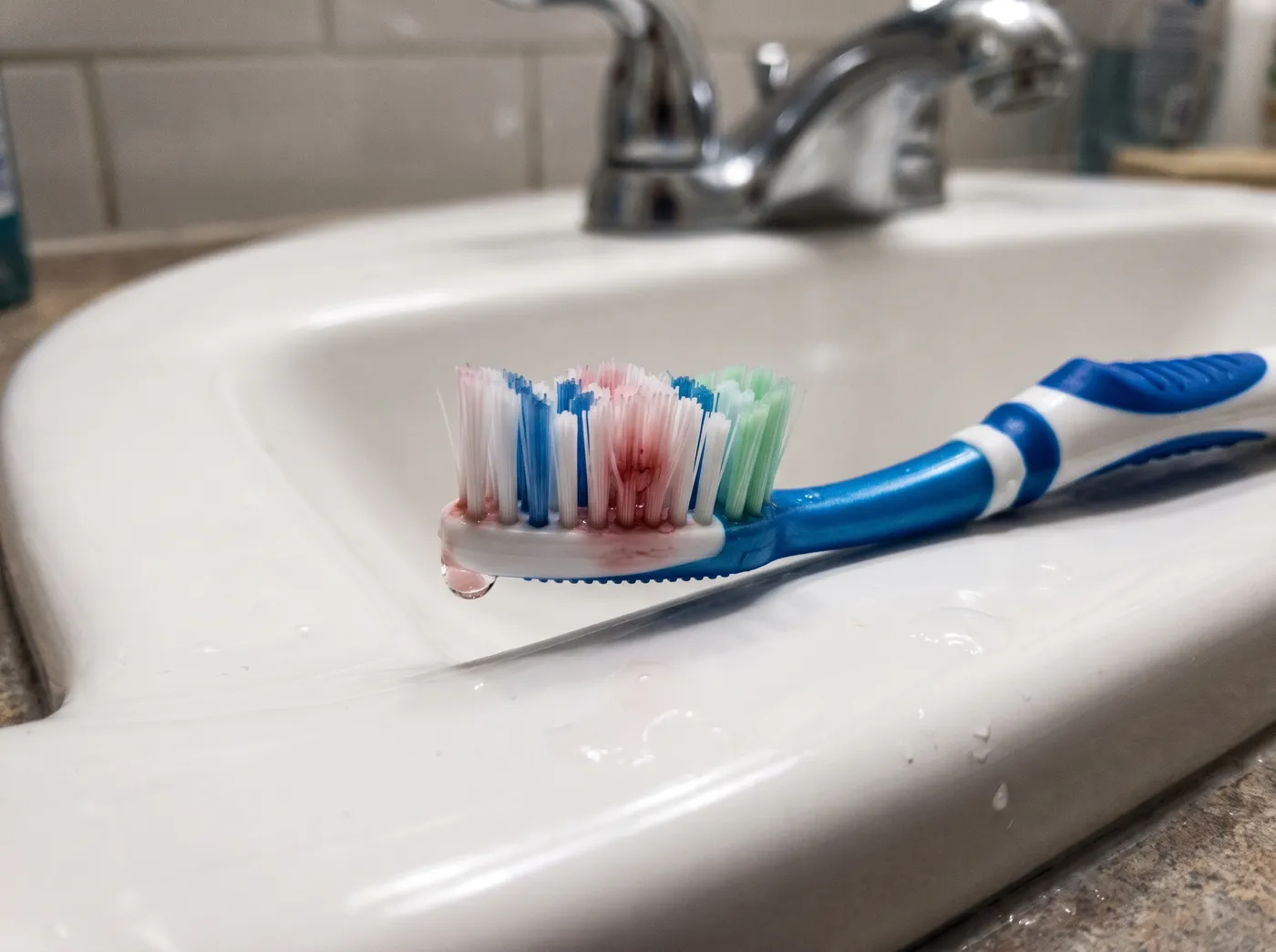 Gum disease treatment signs you may need treatment at Omni Dental in Arlington Heights, IL