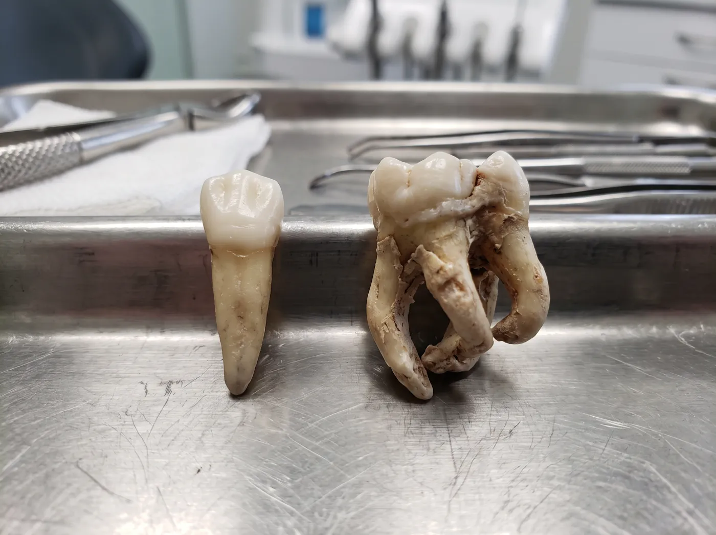 Why does a tooth extraction price vary so much at Omni Dental in Arlington Heights, IL