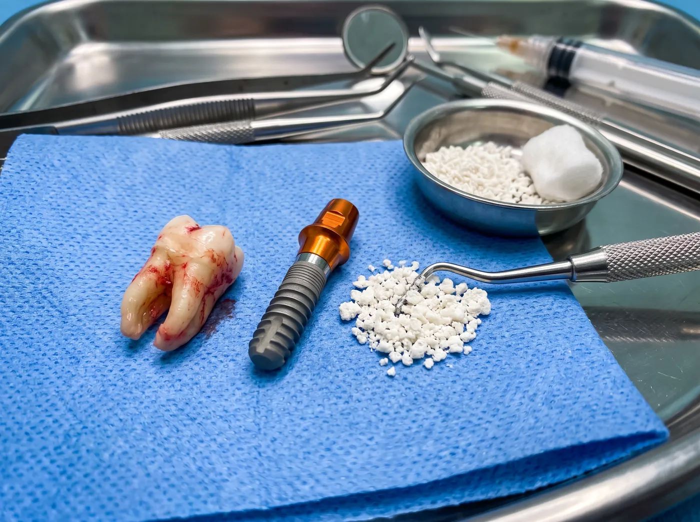 Can you get an implant at the time of the extraction at Omni Dental in Arlington Heights, IL